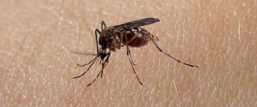 Infección por virus Zika