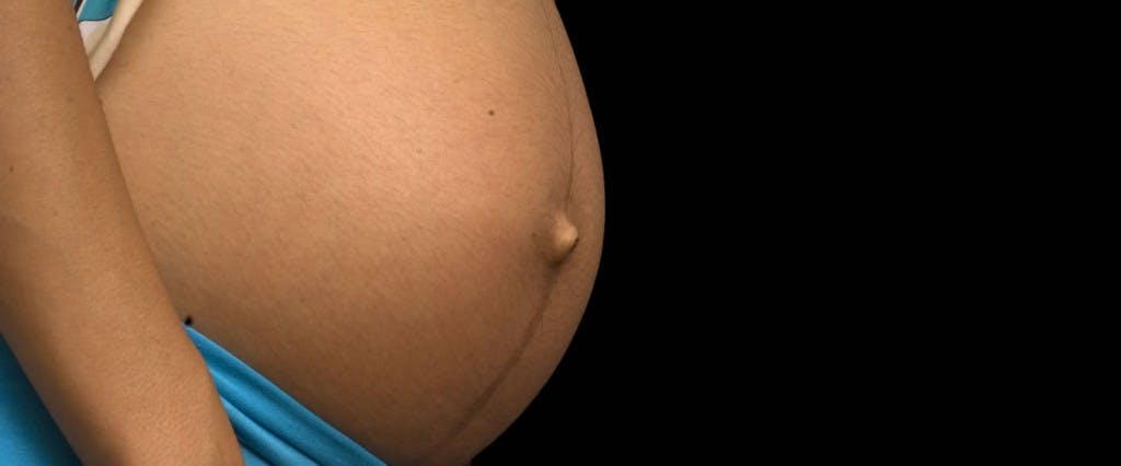 6 respuestas para su piel durante el embarazo