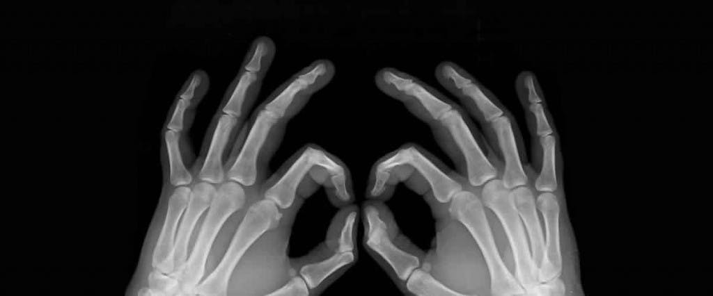 Artritis reumatoide (AR): ¿cómo recuperar el movimiento de manera biológica?